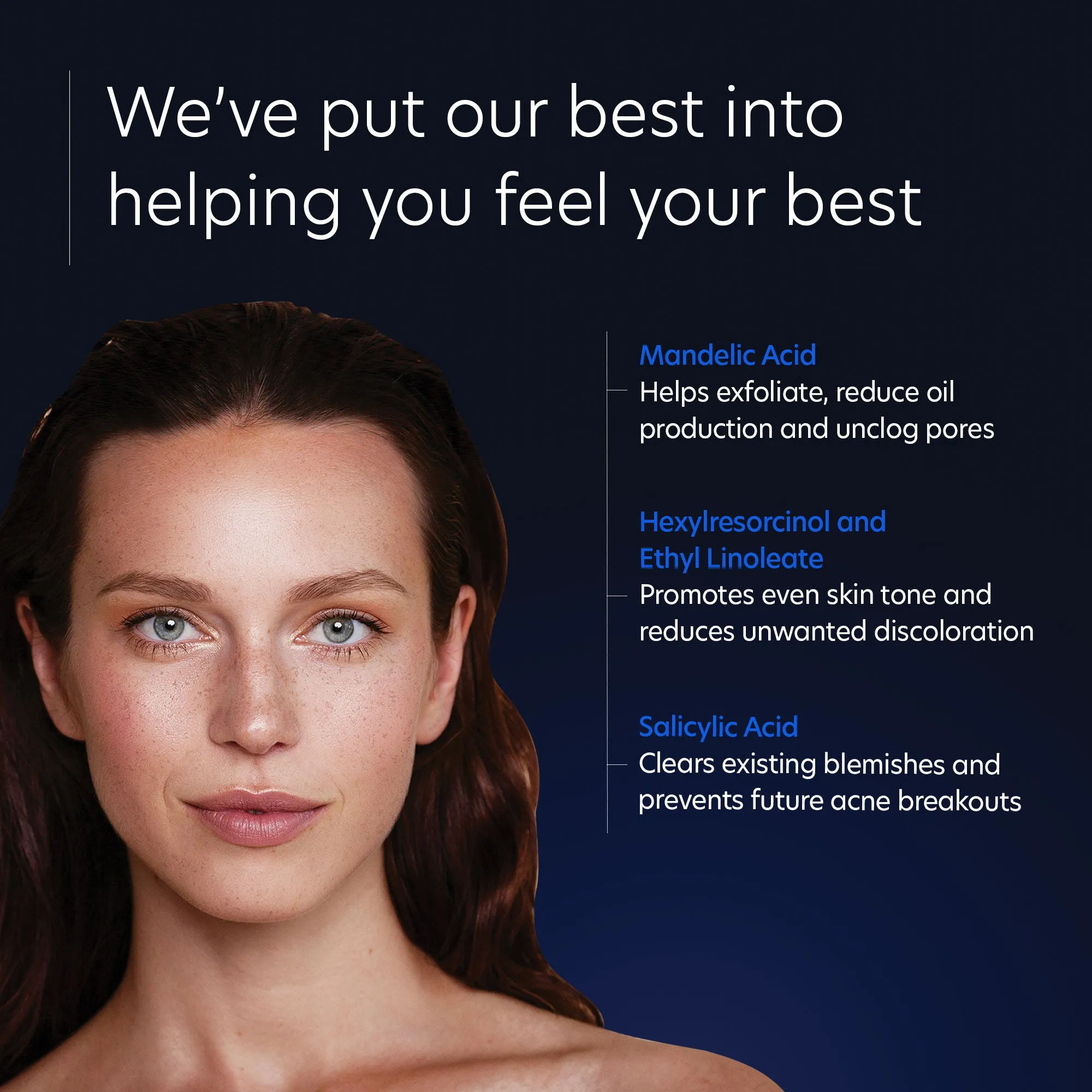 Acne Gel With OmniSome