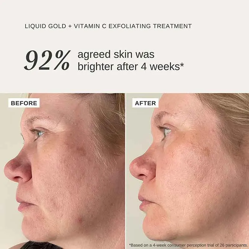 Alpha-H Liquid Gold Exfoliating Treatment with 5% Glycolic Acid and Vitamin C 100ml