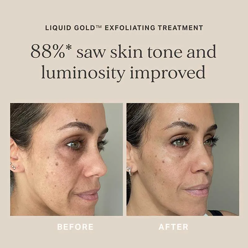 Alpha-H Liquid Gold   FREE Liquid Gold w/ Vitamin C