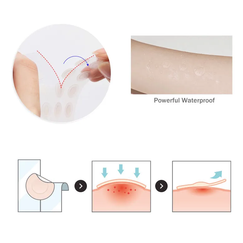 Dr.G A'Clear Spot Cure Patch 39 sheets