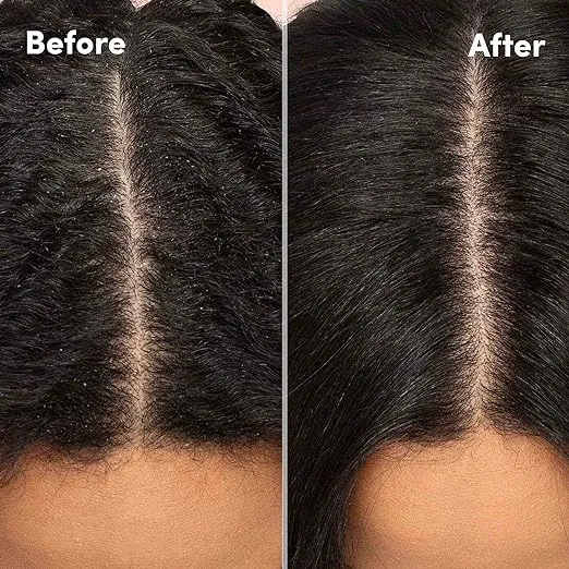 Mizani Scalp Care Reviving & Refreshing Anti-Dandruff Conditioner - 16.9 oz