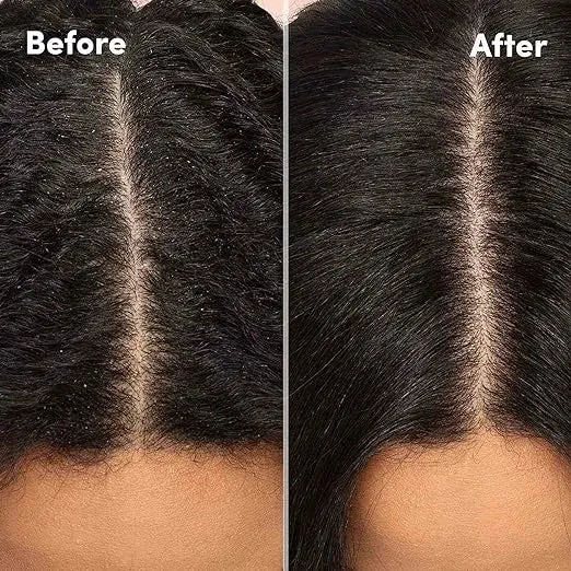 Mizani Scalp Care Reviving & Refreshing Anti-Dandruff Shampoo - 16.9 oz