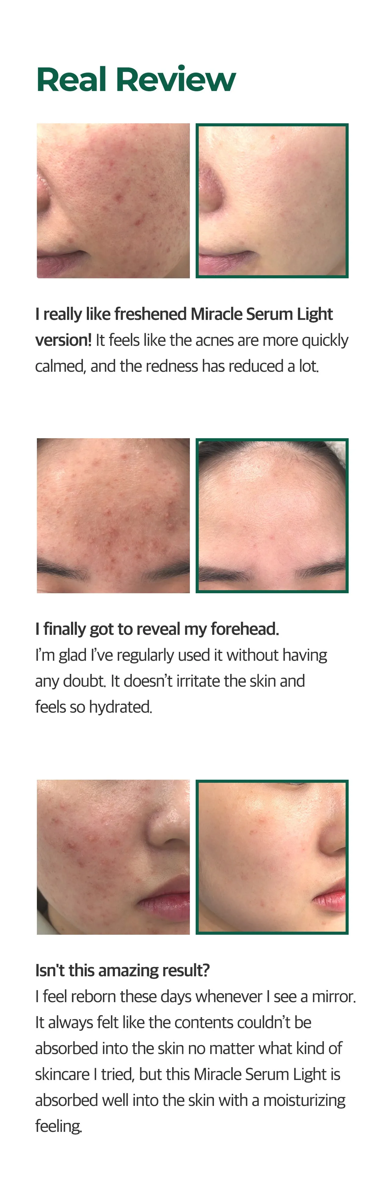 Some By Mi AHA BHA PHA 30 Days Miracle Serum Light 50ml