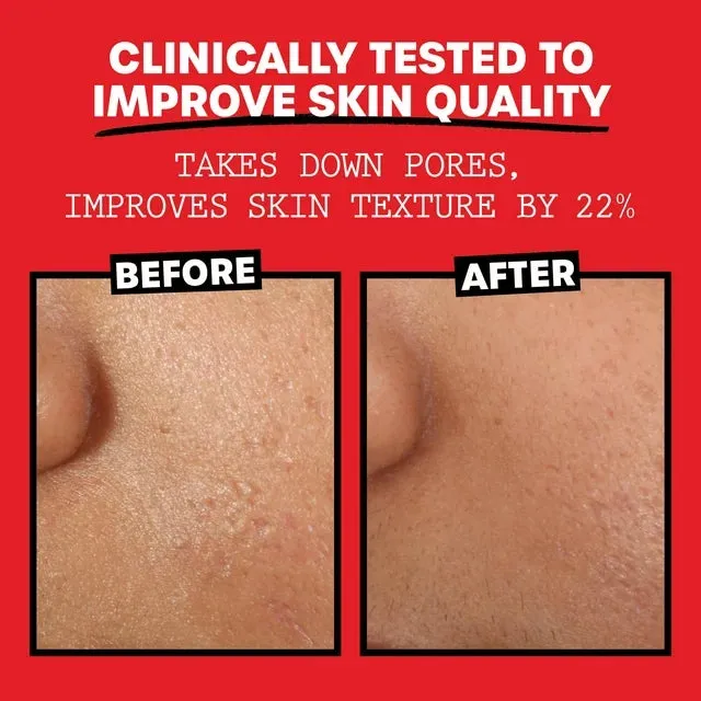 Thayers Alcohol-Free Facial Toner Witch Hazel - 12 oz